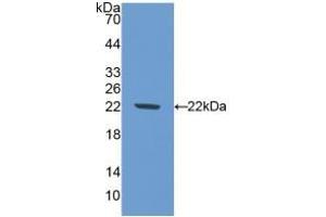 Detection of Recombinant NOS1, Mouse using Polyclonal Antibody to Nitric Oxide Synthase 1, Neuronal (NOS1) (NOS1 抗体  (AA 53-247))