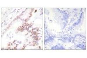 Immunohistochemistry (IHC) image for anti-Prostaglandin E Receptor 3 (Subtype EP3) (PTGER3) (N-Term) antibody (ABIN7184493)