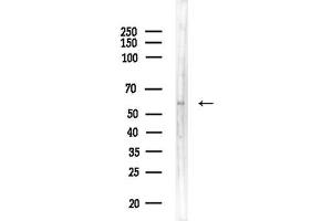 Western blot analysis of lysates from EC304 cells, using ZKSCAN3 Antibody at 1/1000 dilution.