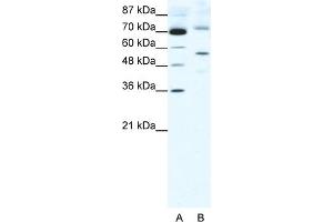 WB Suggested Anti-SIRT3 Antibody Titration:  2. (SIRT3 抗体  (Middle Region))