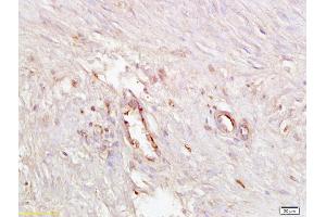 Formalin-fixed and paraffin embedded human endometrial tissue labeled with Anti ICAM4 Polyclonal Antibody, Unconjugated (ABIN873300) at 1:200 followed by conjugation to the secondary antibody and DAB staining (ICAM4 抗体  (AA 85-180))