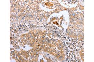 Immunohistochemistry (IHC) image for anti-Cyclin-Dependent Kinase 20 (CDK20) antibody (ABIN3016460) (CCRK 抗体)