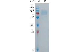 SDS-PAGE (SDS) image for Fc Fragment of IgG, Low Affinity IIIb, Receptor (CD16b) (FCGR3B) (AA 17-199) protein (Fc Tag) (ABIN7491477)