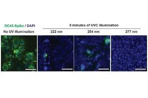 Infection of human lung cell line, HCT-8 from irradiated and untreated hCoV-OC43. (hCoV-OC43 Spike 抗体  (AA 15-344))