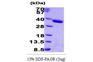 SDS-PAGE (SDS) image for Esterase D (ESD) (AA 1-282) protein (His tag) (ABIN666893) (Esterase D Protein (ESD) (AA 1-282) (His tag))