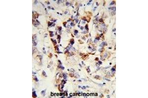 Immunohistochemistry (IHC) image for anti-Superkiller Viralicidic Activity 2-Like 2 (SKIV2L2) antibody (ABIN3003891) (MTR4 抗体)
