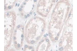 DAB staining on IHC-P; Samples: Human Kidney Tissue (LETMD1 抗体  (AA 162-347))