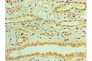 Immunohistochemistry of paraffin-embedded human kidney tissue using ABIN7167832 at dilution of 1:100 (RDH11 抗体  (AA 22-318))