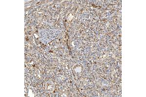 IHC analysis of TXNDC5 using anti-TXNDC5 antibody (ABIN7599699).