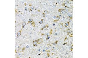 Immunohistochemistry of paraffin-embedded mouse brain using PDYN antibody (ABIN6129606, ABIN6145418, ABIN6145419 and ABIN6221524) at dilution of 1:100 (40x lens). (PDYN 抗体  (AA 21-254))