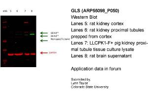 Western Blotting (WB) image for anti-Glutaminase (GLS) (C-Term) antibody (ABIN2786054) (Glutaminase 抗体  (C-Term))