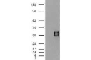 Western Blotting (WB) image for anti-Epithelial Cell Adhesion Molecule (EPCAM) (AA 24-265) antibody (ABIN2717851)