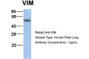 Western Blotting (WB) image for anti-Vimentin (VIM) (C-Term) antibody (ABIN2783289)