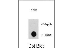 Dot blot analysis of anti-ABL-p Pab (R) on nitrocellulose membrane.