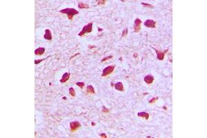 Immunohistochemical analysis of RANBP6 staining in human brain formalin fixed paraffin embedded tissue section. (RANBP6 抗体  (Center))
