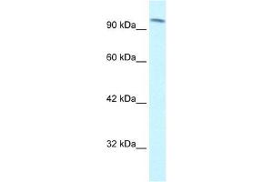 Human Jurkat; WB Suggested Anti-SMARCC1 Antibody Titration: 1.