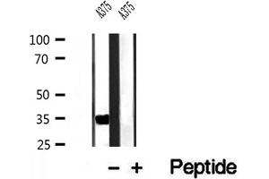 Western blot analysis of extracts of A375 cells, using DHRS3 antibody.