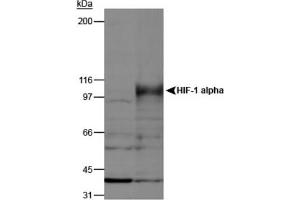 Image no. 3 for anti-Hypoxia Inducible Factor 1, alpha Subunit (Basic Helix-Loop-Helix Transcription Factor) (HIF1A) (AA 432-528) antibody (ABIN363317)