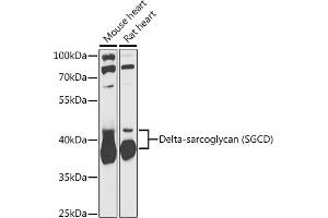 Western blot analysis of extracts of various cell lines, using Delta-sarcoglycan (Delta-sarcoglycan (SGCD)) antibody (ABIN6130325, ABIN6147699, ABIN6147701 and ABIN6217312) at 1:1000 dilution. (SGCD 抗体  (AA 61-290))