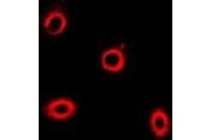 Immunofluorescent analysis of HIP1 staining in U2OS cells. (HIP1 抗体)