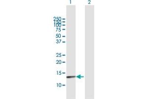 Western Blot analysis of PTS expression in transfected 293T cell line by PTS MaxPab polyclonal antibody. (PTS 抗体  (AA 1-145))