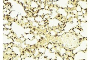 ABIN6274326 at 1/100 staining Mouse lung tissue by IHC-P. (AKAP13 抗体  (Internal Region))