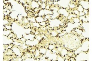 ABIN6274326 at 1/100 staining Mouse lung tissue by IHC-P.