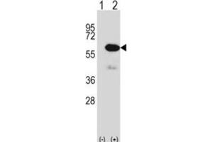 Western Blotting (WB) image for anti-Methionyl Aminopeptidase 2 (METAP2) antibody (ABIN2997955) (METAP2 抗体)