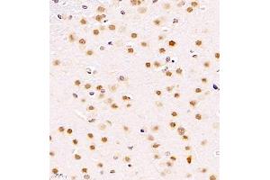 Immunohistochemistry (Paraffin-embedded Sections) (IHC (p)) image for anti-Zinc Finger and SCAN Domain Containing 25 (ZSCAN25) antibody (ABIN7076253)