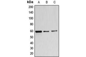 Western blot analysis of B4GALNT1 expression in MDAMB453 (A), A549 (B), K562 (C) whole cell lysates. (B4GALNT1 抗体  (Center))