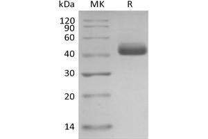 Western Blotting (WB) image for Interleukin 5 (IL5) protein (mFc Tag) (ABIN7319796) (IL-5 Protein (mFc Tag))