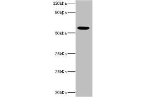 Western blot All lanes: IFNAR2 antibody at 10 μg/mL + MCF-7 whole cell lysate Secondary Goat polyclonal to rabbit IgG at 1/10000 dilution Predicted band size: 58, 38, 28 kDa Observed band size: 58 kDa (IFNAR2 抗体  (AA 27-243))