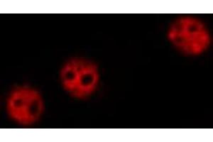 ABIN6267430 staining HeLa by IF/ICC.