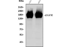 Western blot analysis of EGFR using anti-EGFR antibody (ABIN5518909). (EGFR 抗体  (N-Term))