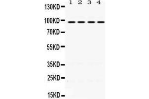 Western Blotting (WB) image for anti-Programmed Cell Death 6 Interacting Protein (PDCD6IP) (AA 2-330) antibody (ABIN3043596) (ALIX 抗体  (AA 2-330))
