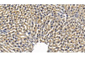 Detection of TBK1 in Mouse Liver Tissue using Polyclonal Antibody to TANK Binding Kinase 1 (TBK1)