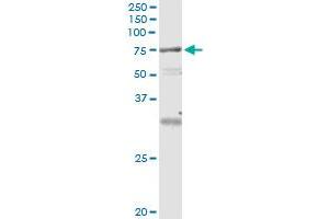 Immunoprecipitation (IP) image for anti-Vacuolar Protein Sorting 18 Homolog (VPS18) (AA 3-101) antibody (ABIN961169) (VPS18 抗体  (AA 3-101))