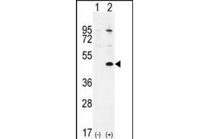 Western blot analysis of TGIF1 (arrow) using rabbit polyclonal TGIF1 Antibody (Center ) (ABIN655999 and ABIN2845378). (TGIF1 抗体  (AA 208-237))