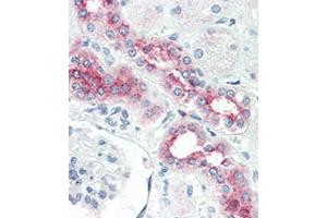 Formalin-fixed and paraffin-embedded human Kidney tissue reacted with BR2 antibody (N-term) (ABIN388741 and ABIN2850427) , which was peroxidase-conjugated to the secondary antibody, followed by AEC staining. (BMPR2 抗体  (N-Term))