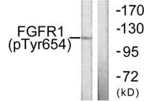 Western blot analysis of extracts from 293 cells treated with Insulin 0. (FGFR1 抗体  (pTyr654))