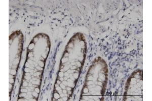 Immunostaining (ISt) image for anti-Homeobox D11 (HOXD11) (AA 1-76) antibody (ABIN561358)