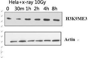 Western Blot (WB) analysis: Please contact us for more details. (Histone 3 抗体  (H3K9me3))