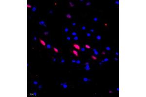 Immunofluorescence of paraffin embedded rat spinal cord using USP27 (ABIN7076113) at dilution of 1:1500 (400x lens) (USP27X 抗体)