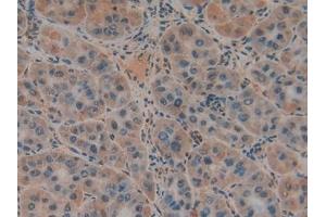 Immunohistochemistry (IHC) image for anti-Plasminogen Activator, Urokinase Receptor (PLAUR) (AA 13-114) antibody (ABIN7431179)