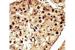 Immunohistochemistry (IHC) image for anti-Transient Receptor Potential Cation Channel, Subfamily M, Member 7 (TRPM7) (AA 1821-1850) antibody (ABIN3029239)