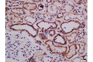 Formalin-fixed and paraffin embedded human kidney labeled with Anti-ATG101 Polyclonal Antibody, Unconjugated  at 1:300 followed by conjugation to the secondary antibody and DAB staining. (ATG101 抗体  (AA 121-218))