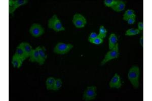 Immunofluorescence staining of HepG2 cells with ABIN7174068 at 1:166, counter-stained with DAPI. (SYK 抗体  (AA 260-361))