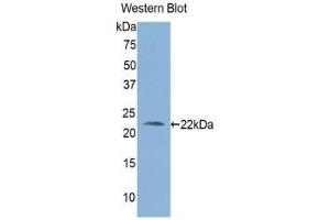 Western Blotting (WB) image for anti-Aldehyde Dehydrogenase 1 Family, Member A3 (ALDH1A3) (AA 332-509) antibody (ABIN1176368) (ALDH1A3 抗体  (AA 332-509))
