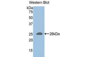 Western blot analysis of the recombinant protein. (ADAMTS1 抗体  (AA 258-467))