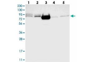 Western blot analysis of Lane 1: RT-4, Lane 2: U-251 MG, Lane 3: Human Plasma, Lane 4: Liver, Lane 5: Tonsil with FOXK1 polyclonal antibody  at 1:250-1:500 dilution. (Foxk1 抗体)